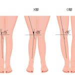 X脚、O脚の治療にピラティスをどう適用しますか？